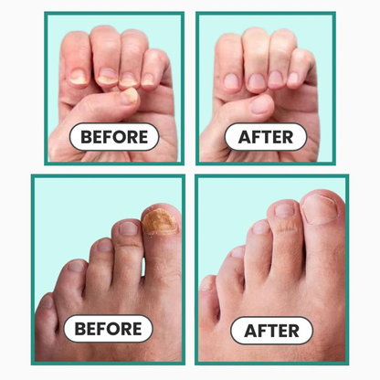 Avenza™ Ortho Vital Device