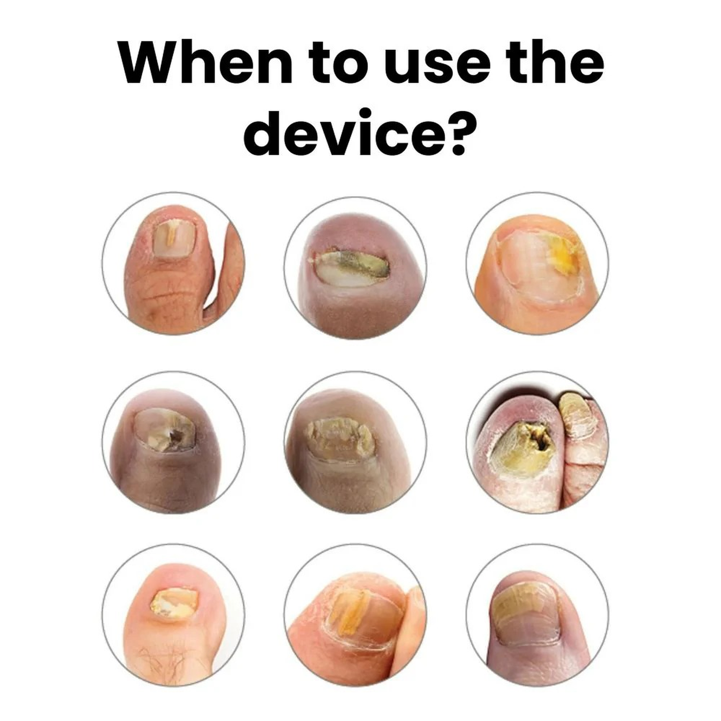 Avenza™ Ortho Vital Device