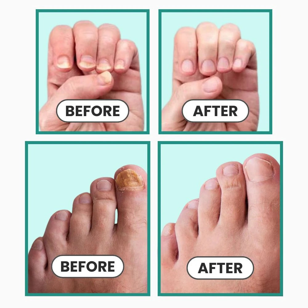 Avenza™ Happy Nails