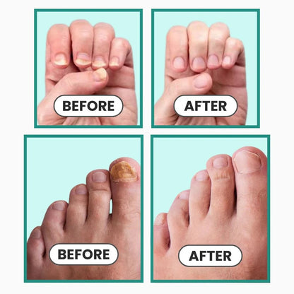Avenza™ Happy Nails